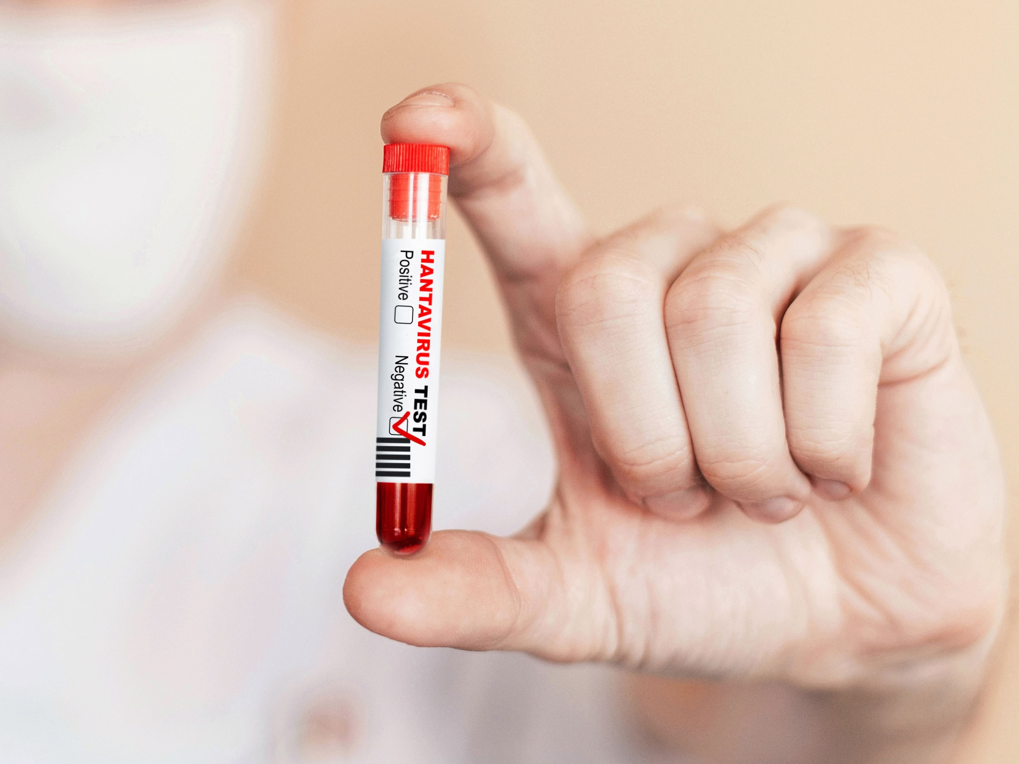 La France et les Pays-Bas annoncent que les tests des personnes contacts au hantavirus sont négatifs