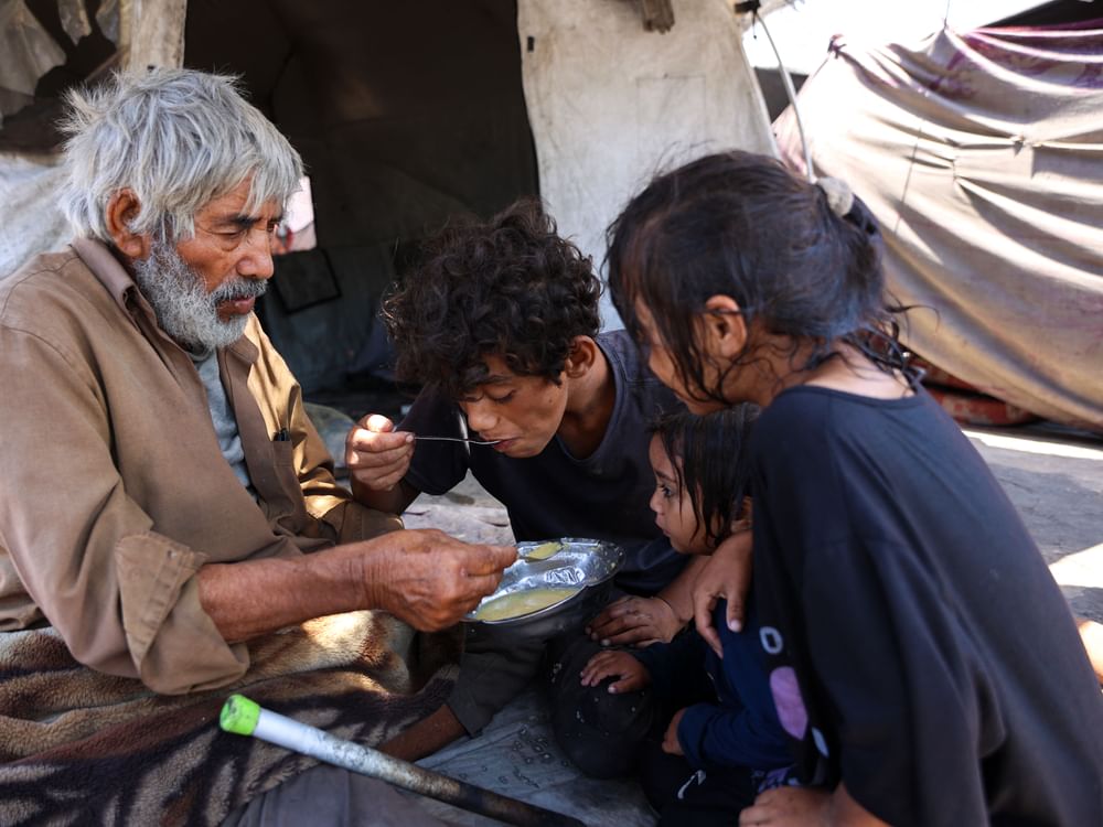 5 حالات وفاة نتيجة سوء التغذية في غزة خلال 24 ساعة