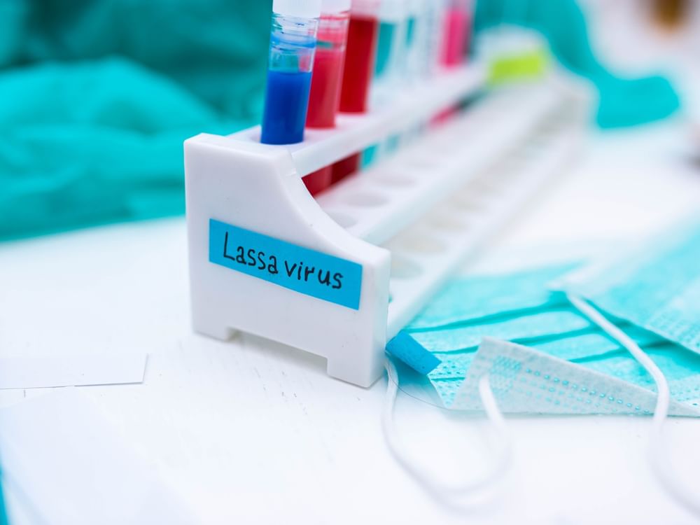 Nigerian scientists develop new vaccine against Lassa fever