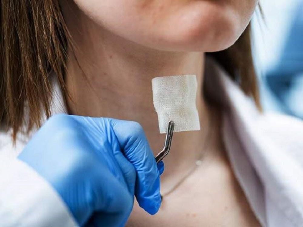 Russian scientists develop first 3D-printed laryngeal implant to accelerate cancer recovery