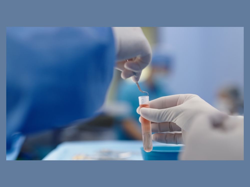 Abu Dhabi Stem Cells Centre pioneers testicular cryopreservation for four boys before bone marrow transplants