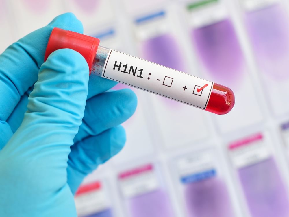 Mexico reports first human case of H5N1 bird flu