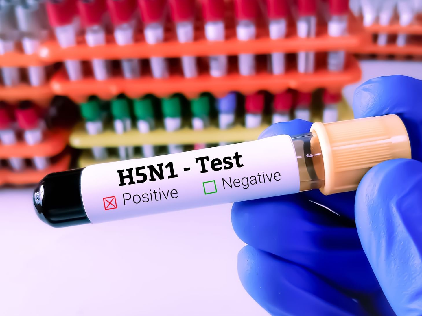 Australia confirms first H5N1 infection in native mammal